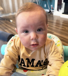 Luke Randall home from the hospital.   Courtesy of Nat Randall